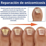 Parches AntiHongos 🩹 y Regeneradores De Uñas - FUNGAL NAIL PATCHES®💊