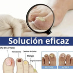 Parches AntiHongos 🩹 y Regeneradores De Uñas - FUNGAL NAIL PATCHES®💊