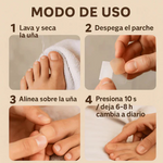 Parches AntiHongos 🩹 y Regeneradores De Uñas - NailPatch®💊